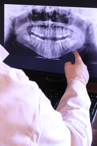 Best Broken or Chipped Tooth Repair in Airmont, NY