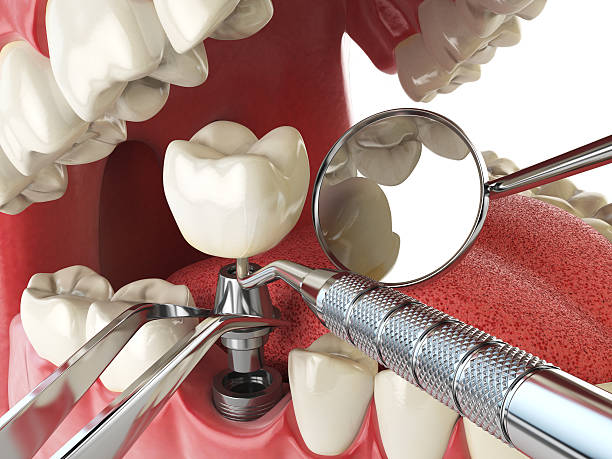 Best Emergency Treatment for Jaw Pain or Injury in Airmont, NY